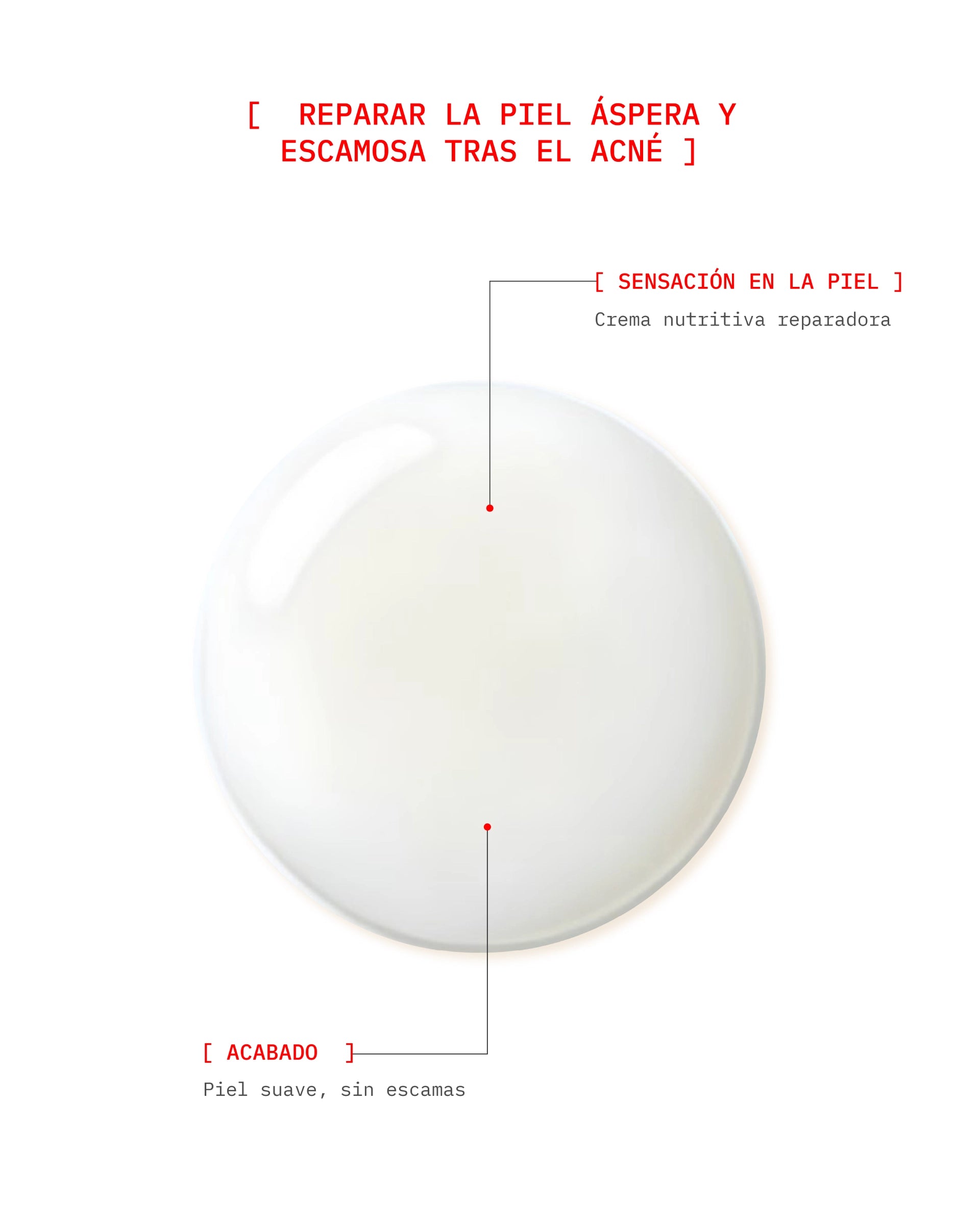 Bye Breakouts Cream (D)