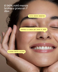 Bye Breakouts Cream Highlights Model Image