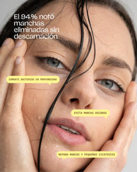 Bye Breakouts Cream Highlights Model Image