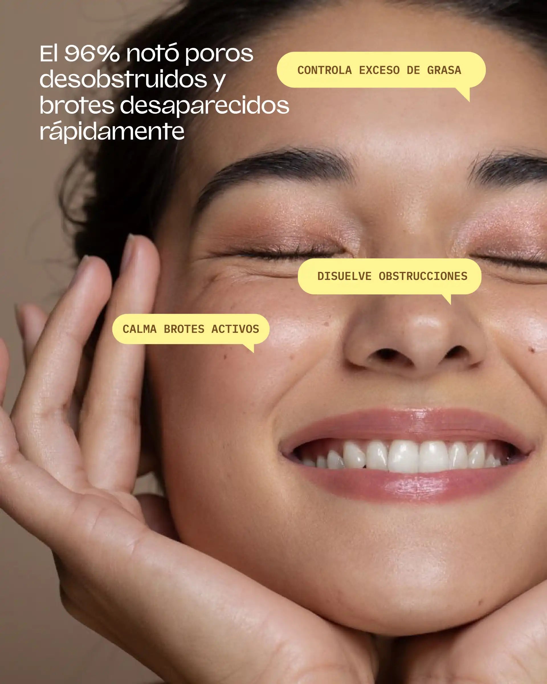 Bye Breakouts Serum (OC)