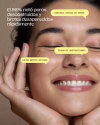 Bye Breakouts Serum Highlights Model Image