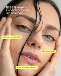 Bye Breakouts Serum Highlights Model Image