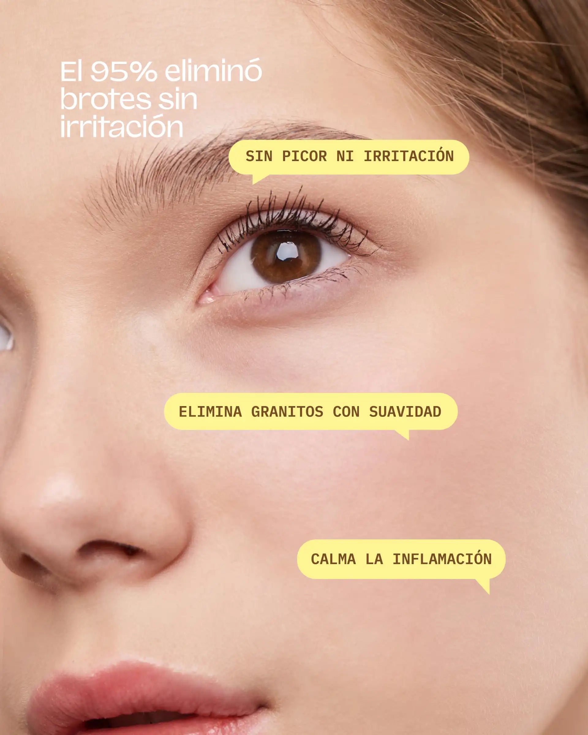 Bye Breakouts Serum (HS)