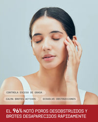 Rutina Completa Antiacné con Niacinamida, Ácido Salicílico, Nelupure, Ácido Hialurónico y Vitamina E para Piel Sensible