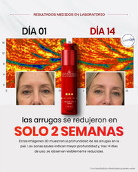 Rutina Completa para Arrugas y Manchas para Piel Sensible